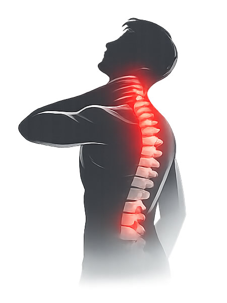 tratamiento de hernia cervical