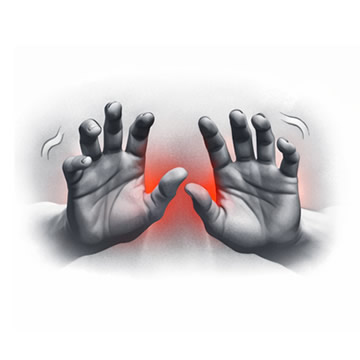 Falta de coordinación marcada