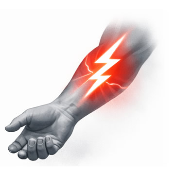 Pérdida de sensibilidad extensa