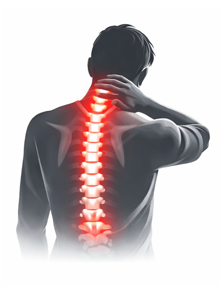 tratamiento de hernia cervical por el MORFT