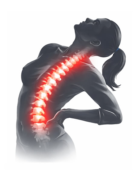 tratamiento de hernia dorsal por el MORFT