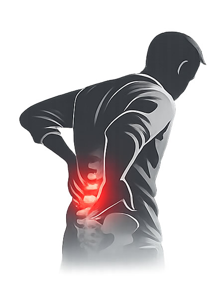 tratamiento de hernia lumbar por el MORFT